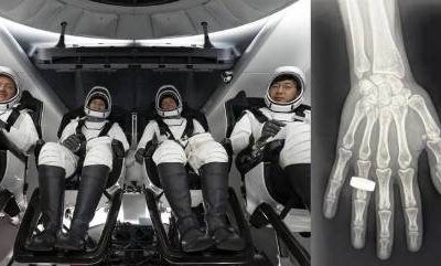 "خلاباز خلا میں پہلی ایکس رے کی تصویر"